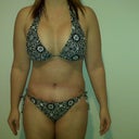 4 weeks post op