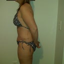 4 weeks post op side