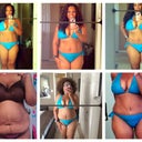 Top row is 5 1/2 months post op.  Bottom row is before, 1 week post op and I think about 5 weeks post op