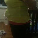 28 days post op