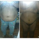 28 days post op very swollen not feeling my body naked i was told it will look better and im hoping it does.