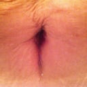My old/new belly button:)  You can see the swelling is higher on my left.  This pic was after working out this morning.