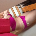 post op 4 days