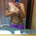 9 hours post op