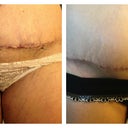 Scar: Week 1 (left) Week 2 (right)