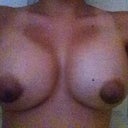 my left breast is the one with mole
