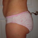 Before surgery