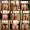 Before and 6 months After