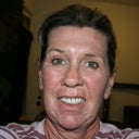 Day 10. Still swollen but not so happy. Starting to see some wrinkles coming back.