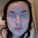 This is me AFTER 8 days on Retin A, sans make up. Disgusting!