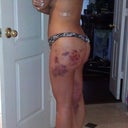 finally the thong shot.  geesh my bruising is still bad.