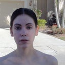 6 weeks after Vi peel.  Don't let this picture fool you.  My skin is really dry and flaky to the touch.