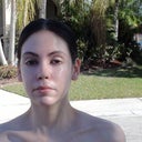 6 week post VI peel. I have a lot of moisturizer and sunblock on here.