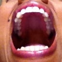 Upper Jaw after Invisalign.  Note the perfectly straight line of teeth.  My line of teeth was quite wavery before, especially the two front teeth, which stuck out unevenly, and the two lateral incisors, which were crooked.