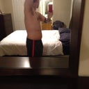 2 weeks Post Op: Side