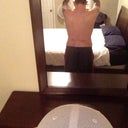 2 weeks Post Op: Back