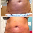 Before and after day 7