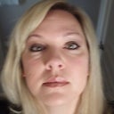 Before Juvederm under eyes