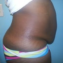 this is my other side view....