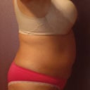 Right Side View 1.31.13