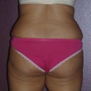 Back View 1.31.13