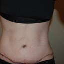 7 days sitting!! yes i am sitting in this picture. and i have no flesh skirt resting on my lap!