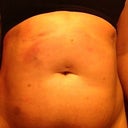 After, day of