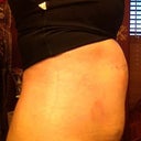 After, day of