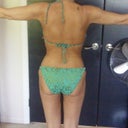 Backside 5 months after surgery