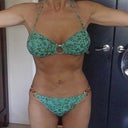 Frontal 5 months after surgery