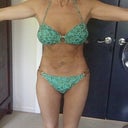 Longer front view 5 months after surgery