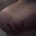 day 2 left side