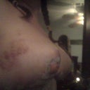 day 2 right side