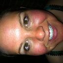 10 hours later, looks like the tan stuff has kicked in more (kinda glad, its helping to camo my spots)