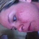 My darkest spot :( kinda looks like the prison tear drop tattoo..this one has got 2 go!