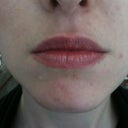 My lips without any filler (natural)