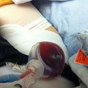 This is what the "drain grenade" looks like