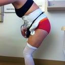 This is my side view 18 hours post surgery.  Can I have any more crap dangling off the front?