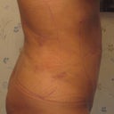 After: Day 3