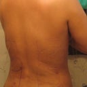 After: Day 3
