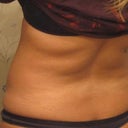 Before: Flanks