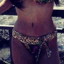 a few months post op may14 surgery this pic taken in August. 3 months post op and it only gets better...