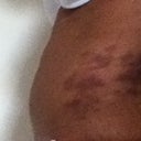 6 dyas after