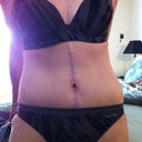 After!