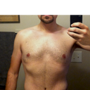 10 months post-op.
