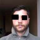 10 days after op, quite upturned nose, nostrils visible