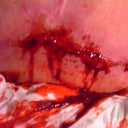 Just a closer view of worst area this week. 02/24/11