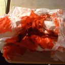 This picture is gross even to myself but it shows just how quickly I do bleed and I usually don't see any clotting until I have soaked approx 8 kleenex and the clotting takes place on the Kleenex more so than my incision.  02/24/11