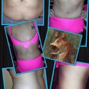 New swimsuit, new pics.   47 days post op.