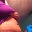 3 1/2 weeks post op